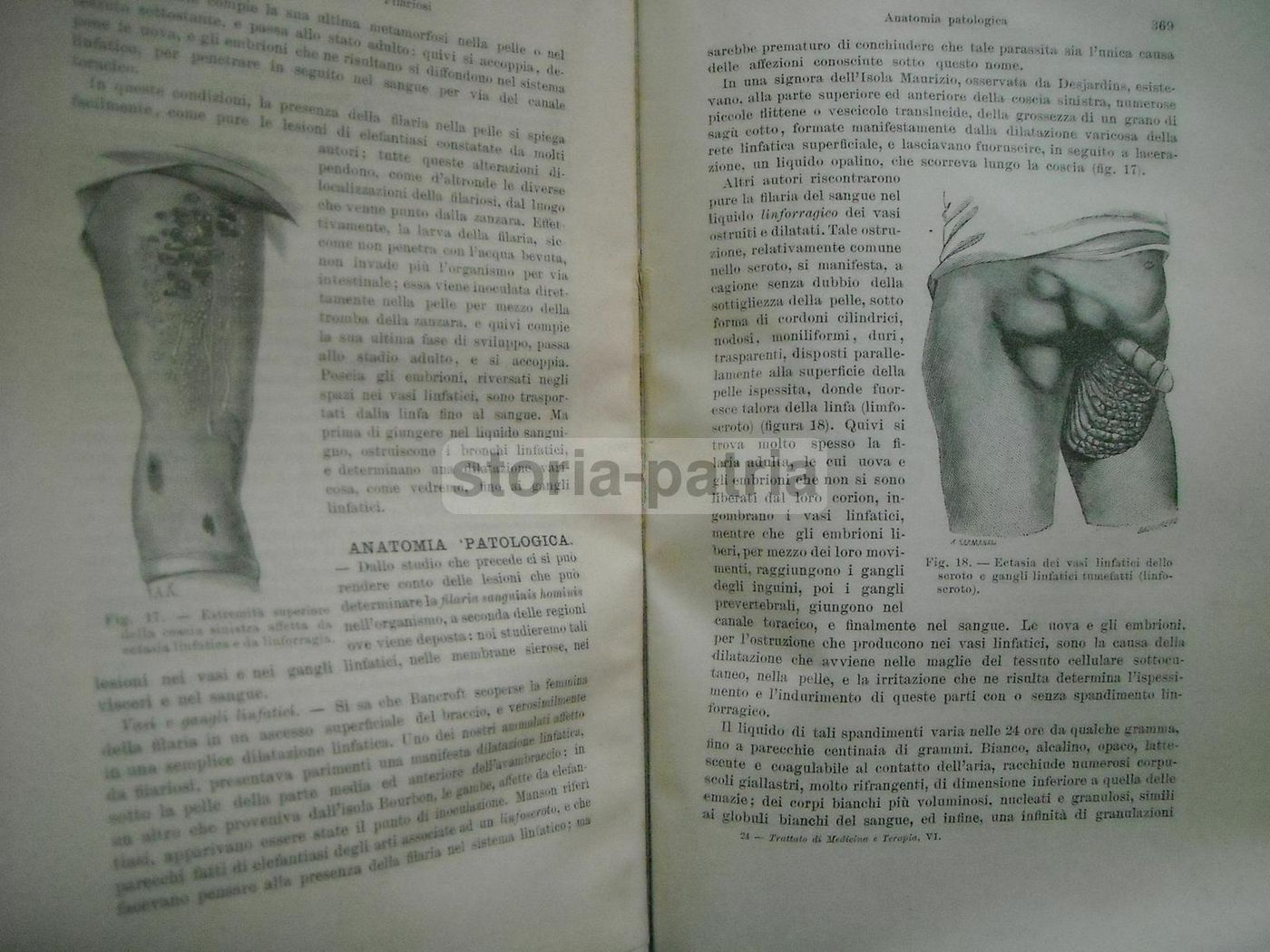 Malattie Esotiche (1907) UTET   Nuovo Trattato Di Medicina E Terapia