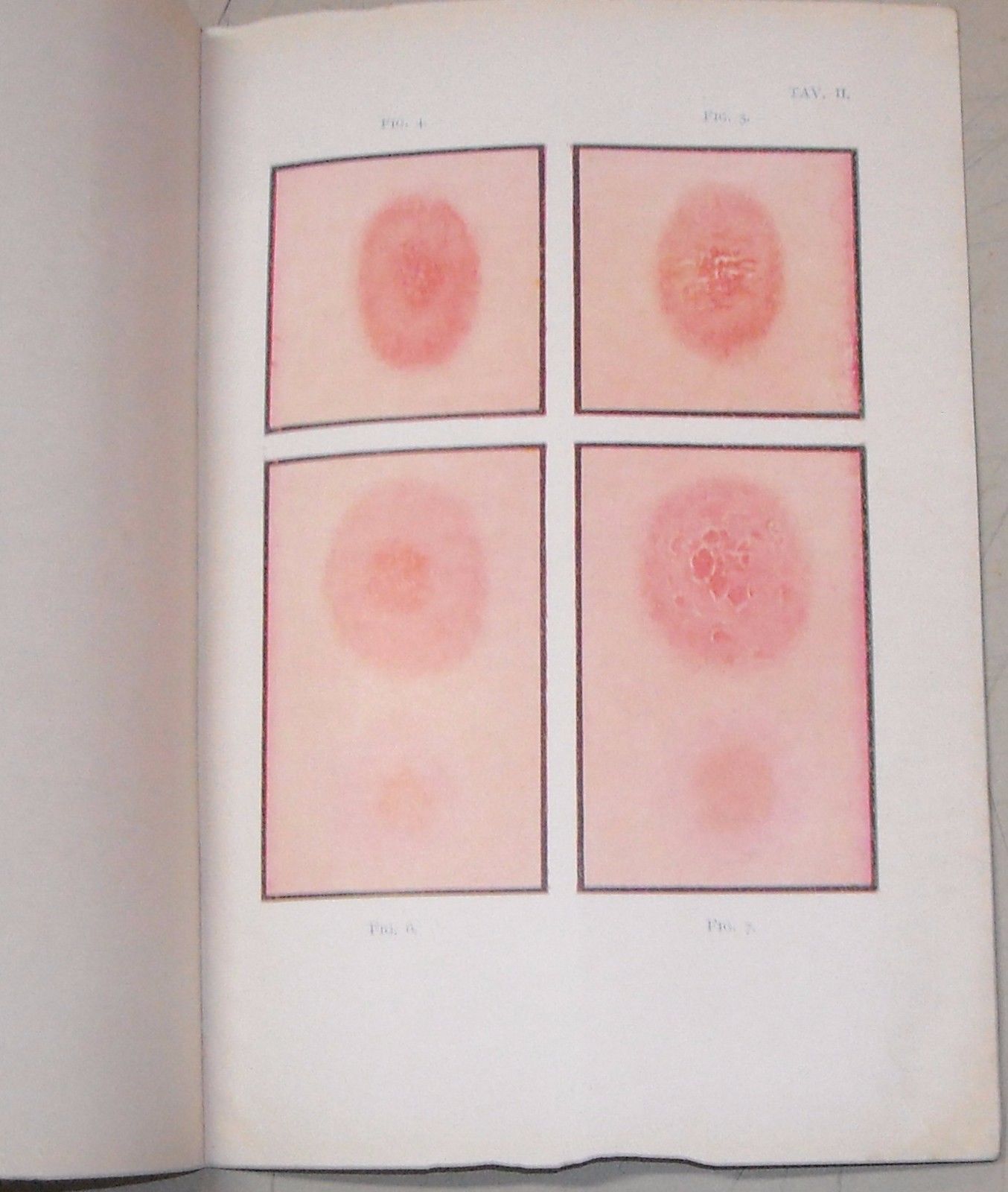 Difterite: Note Epidemiologiche E Profilattiche, 1930