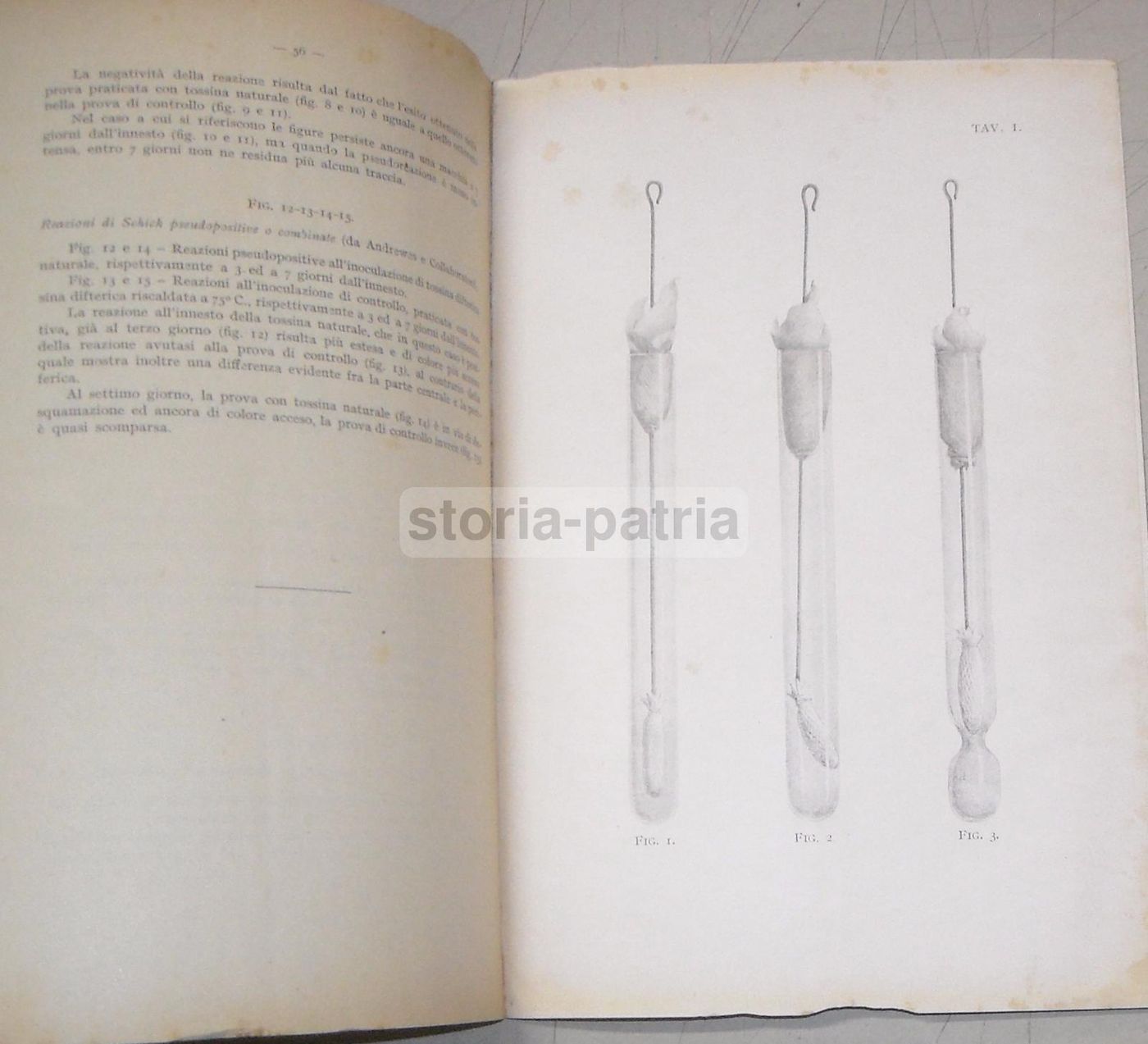 Difterite: Note Epidemiologiche E Profilattiche, 1930