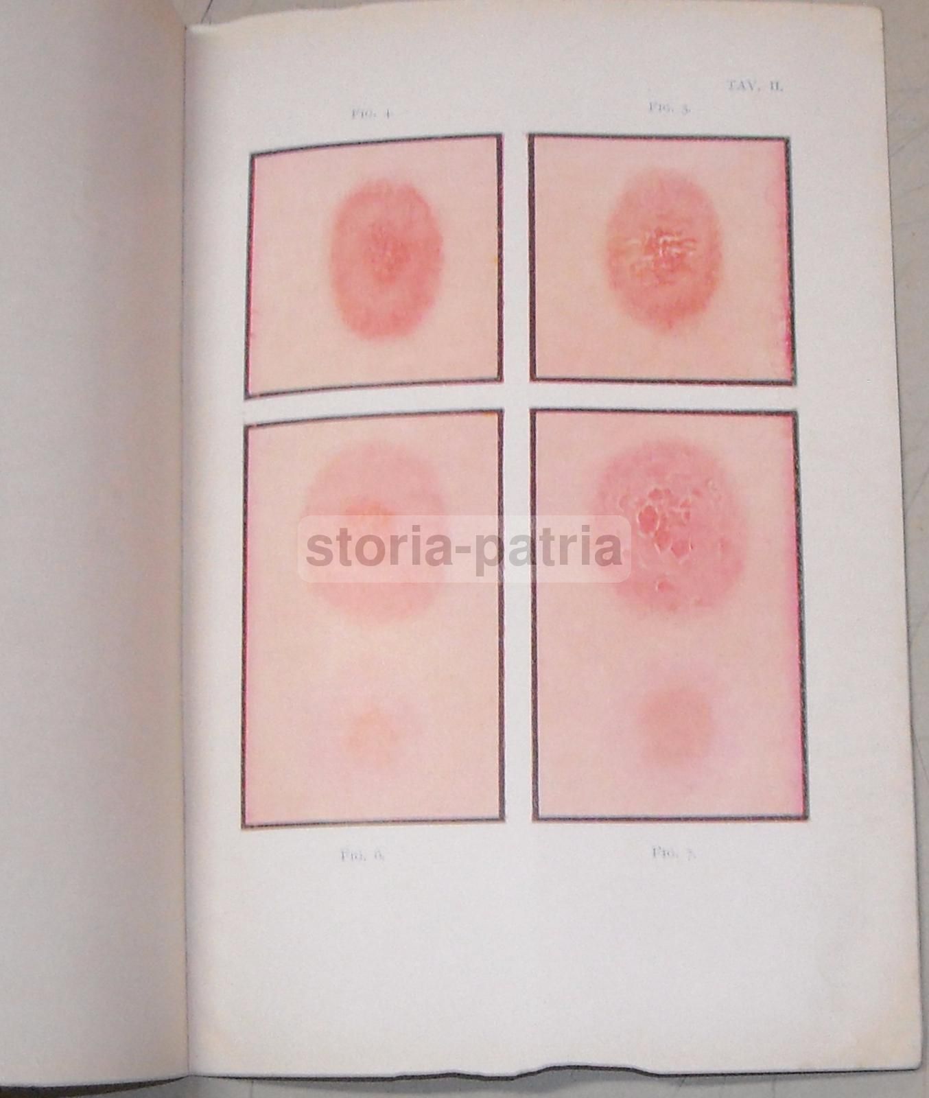 Difterite: Note Epidemiologiche E Profilattiche, 1930