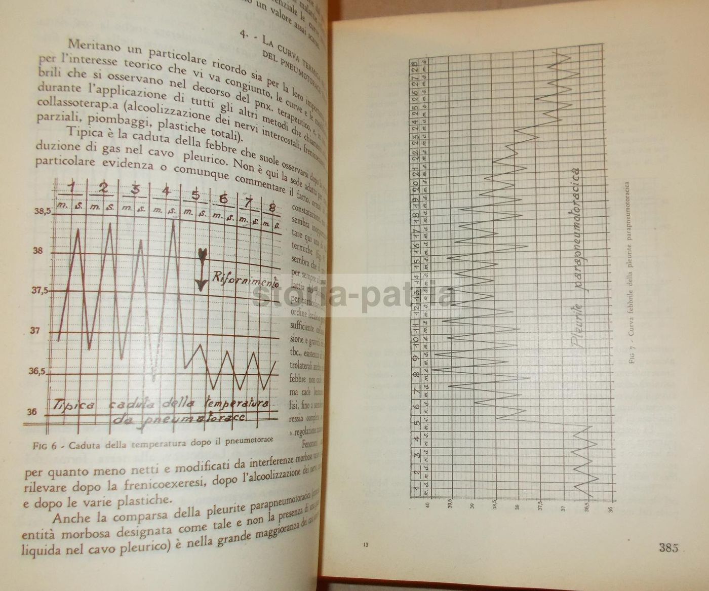 La Tisiologia Nella Pratica Medica. Wassermann, 1933