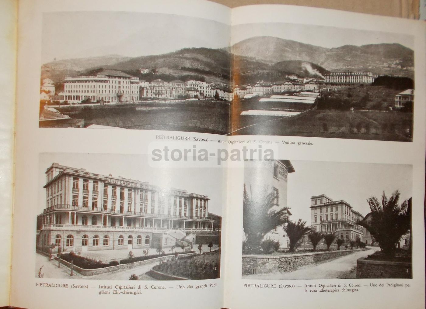 La Tisiologia Nella Pratica Medica. Wassermann, 1933
