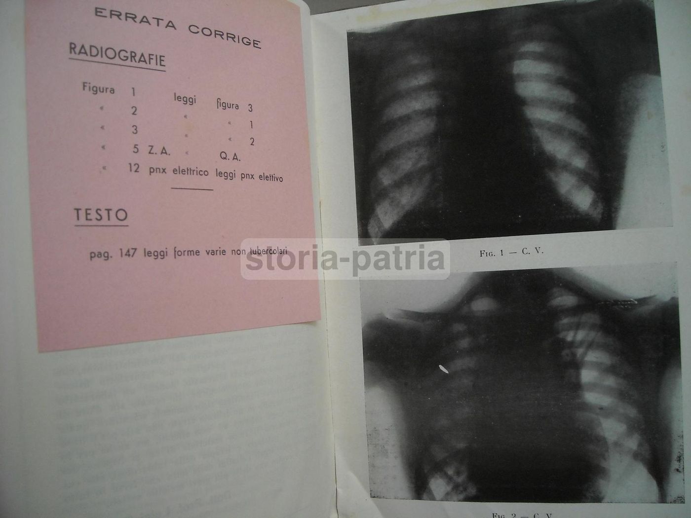 Sanatorio Caputi Napoli 1933 Chirurgia Polmonare Radiologia Medicina