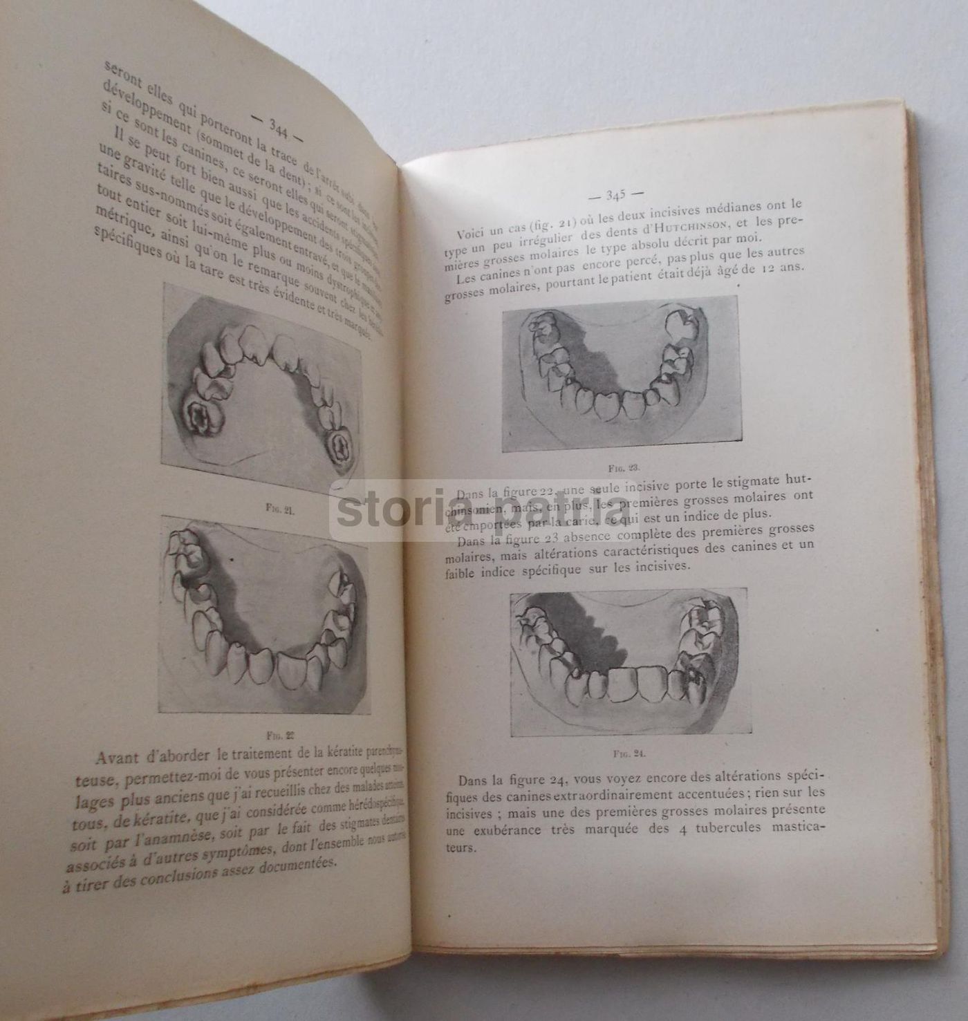 Darier: Leçons De Thérapeutique Oculaire (1909)   Trattato Di Oftalmologia