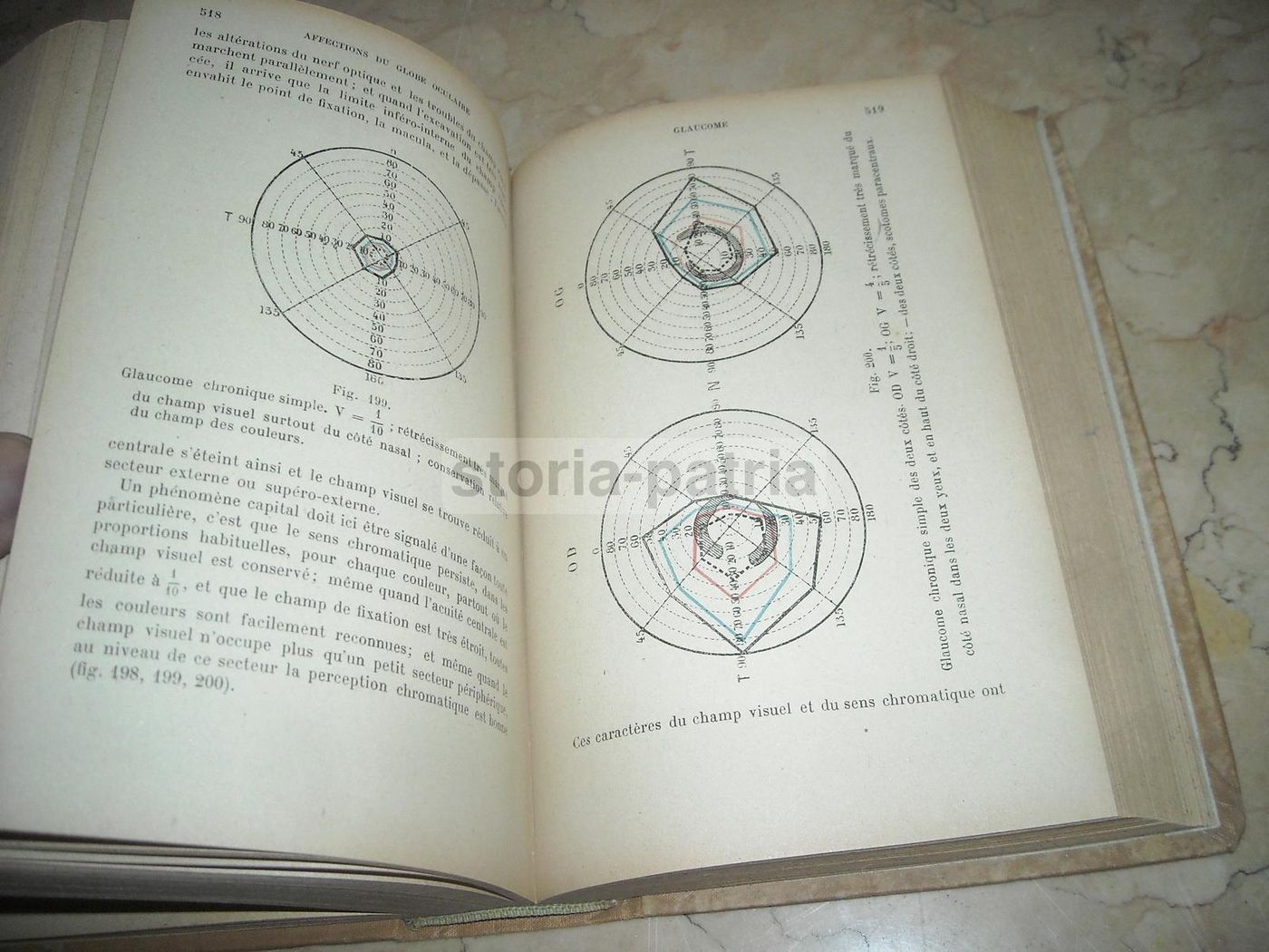 Précis d'Ophtalmologie Lagrange 1921 Illustrato Oftalmologia