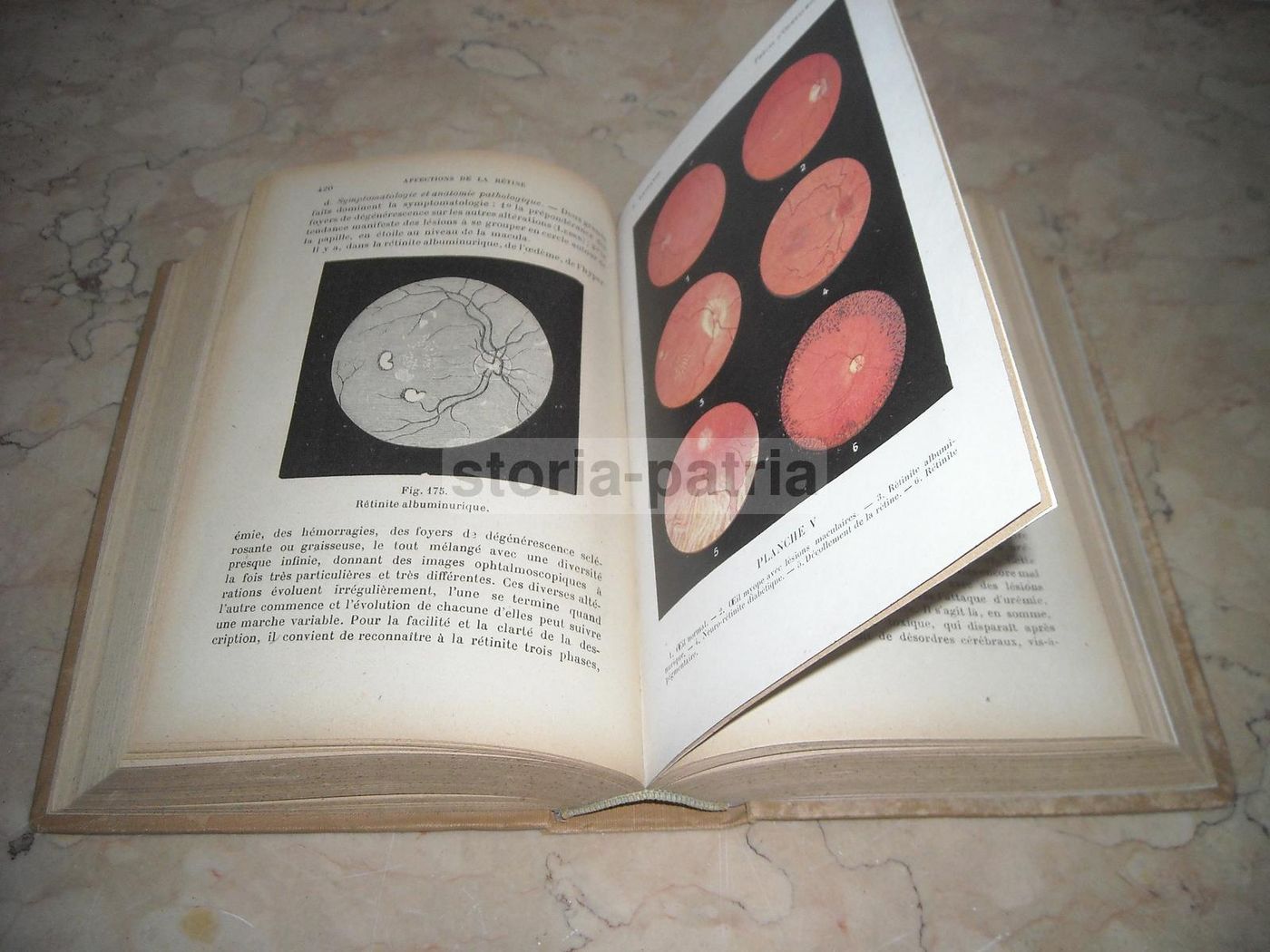 Précis d'Ophtalmologie Lagrange 1921 Illustrato Oftalmologia