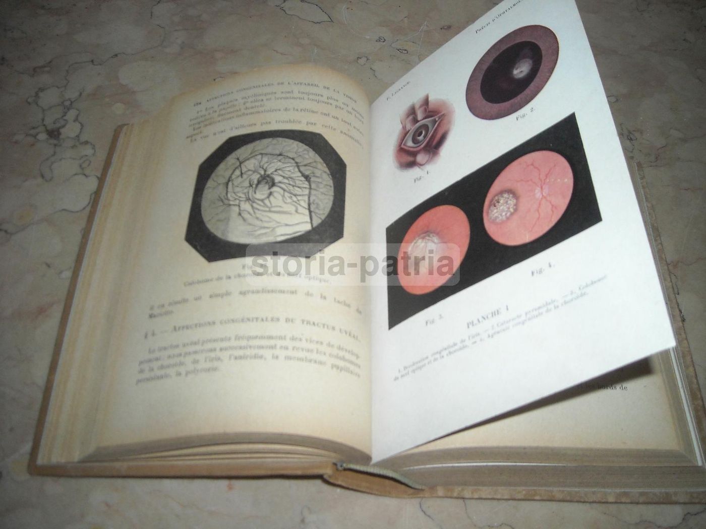 Précis d'Ophtalmologie Lagrange 1921 Illustrato Oftalmologia