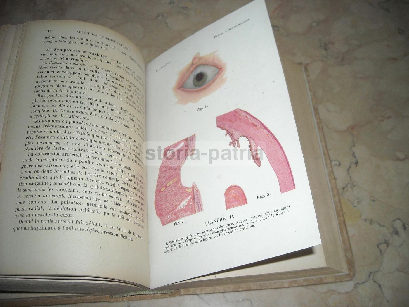 Précis d'Ophtalmologie Lagrange 1921 Illustrato Oftalmologia
