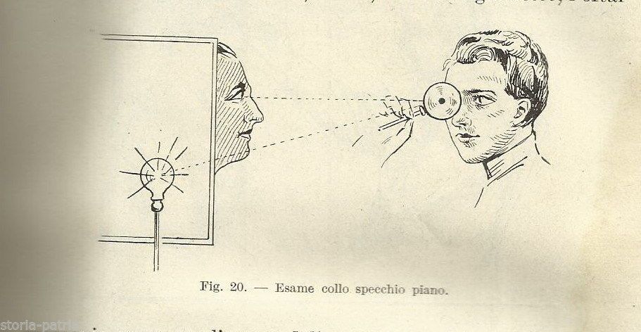 Trattato Pratico Di Oculistica Siro Francesco Piccaluga (1934)