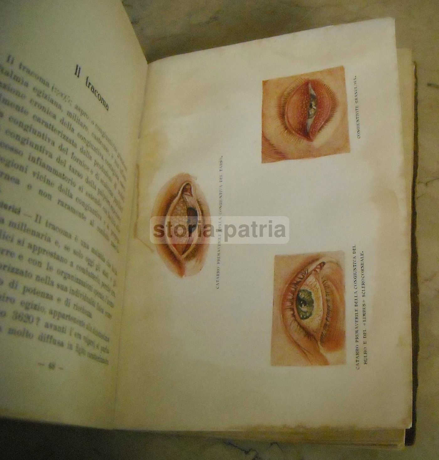 L'Igiene Dell'Occhio Nella Scuola   Angelucci, Rossi   Napoli 1924