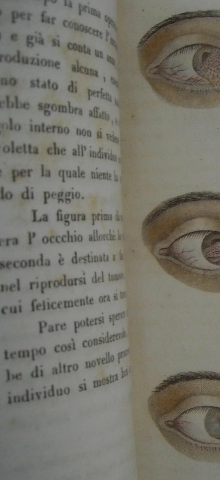 Saggio d'Ecraxis: Barracano, 1829   Chirurgia Oculistica E Cataratta