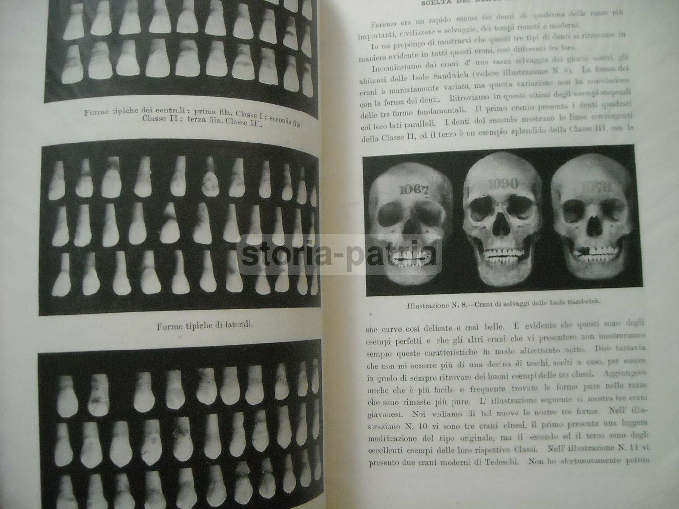 Scelta Dei Denti Artificiali: Sistema Anatoform Di J. Leon Williams (1920)