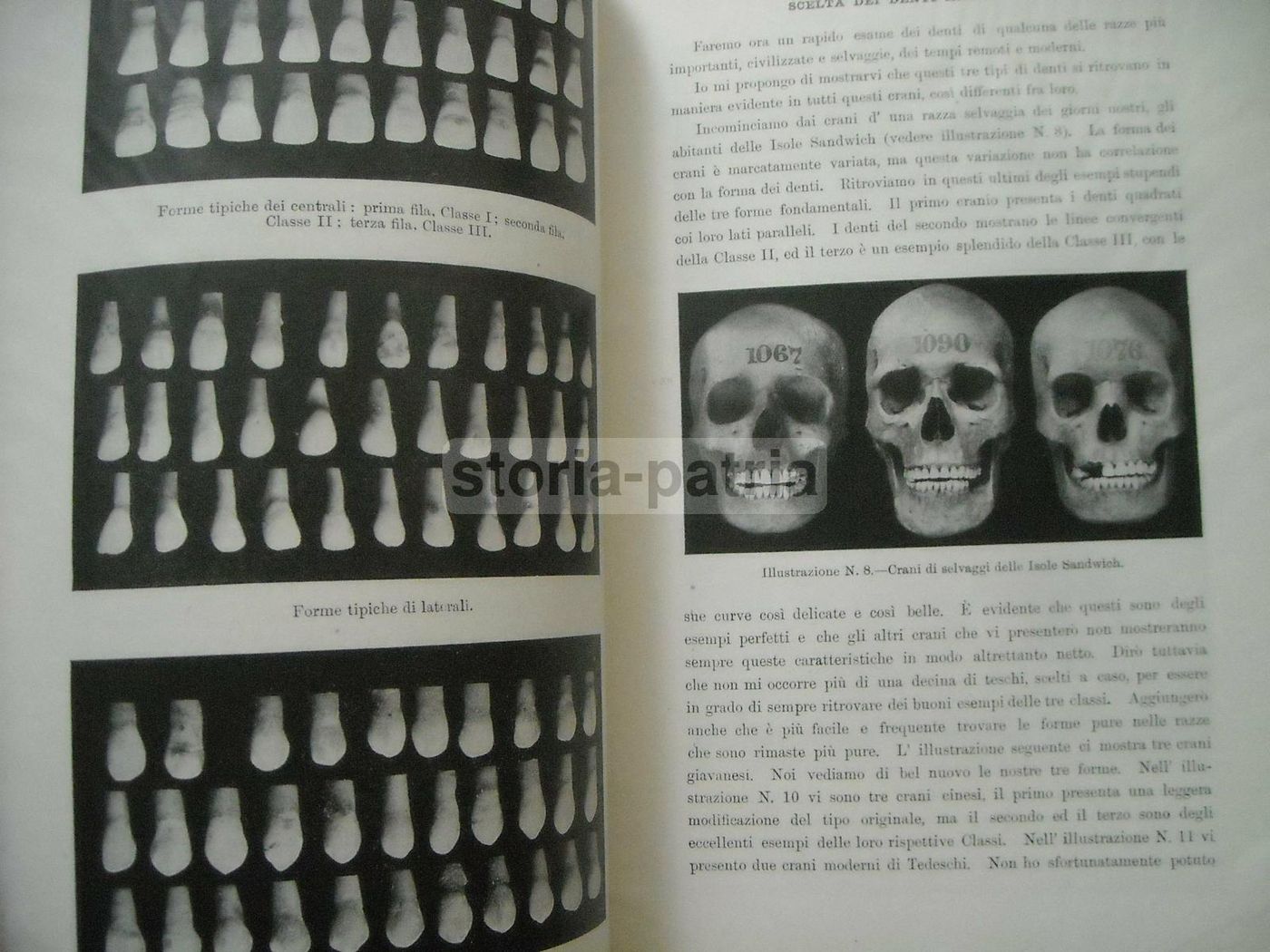 Scelta Dei Denti Artificiali: Sistema Anatoform Di J. Leon Williams (1920)