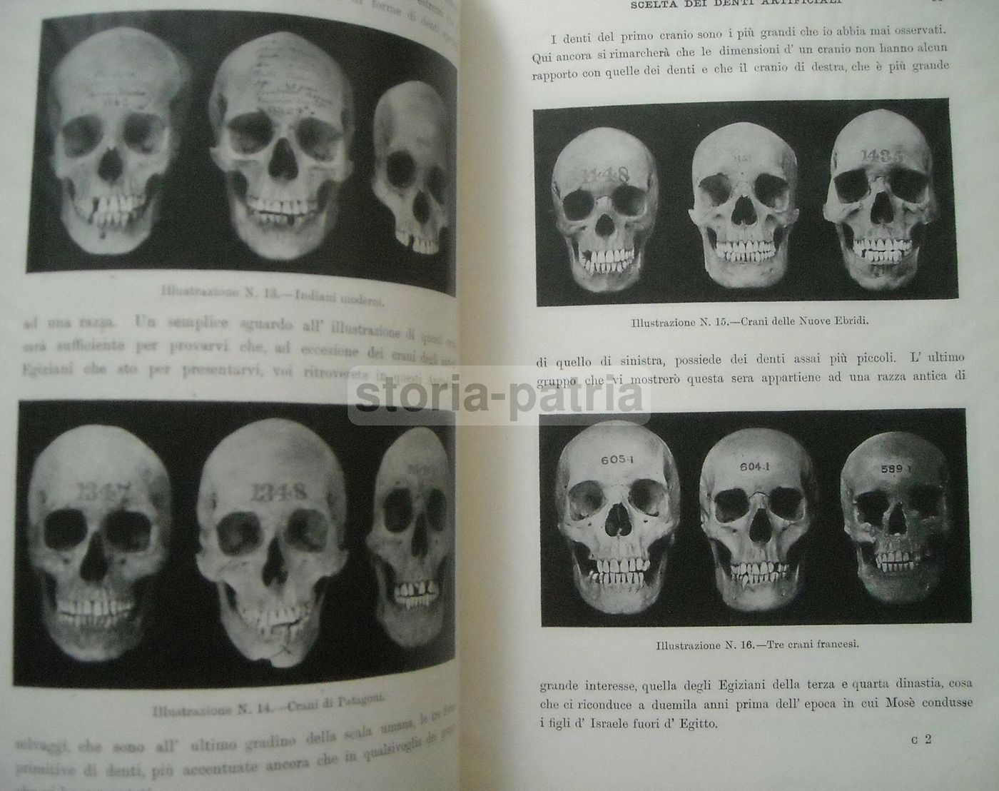 Scelta Dei Denti Artificiali: Sistema Anatoform Di J. Leon Williams (1920)