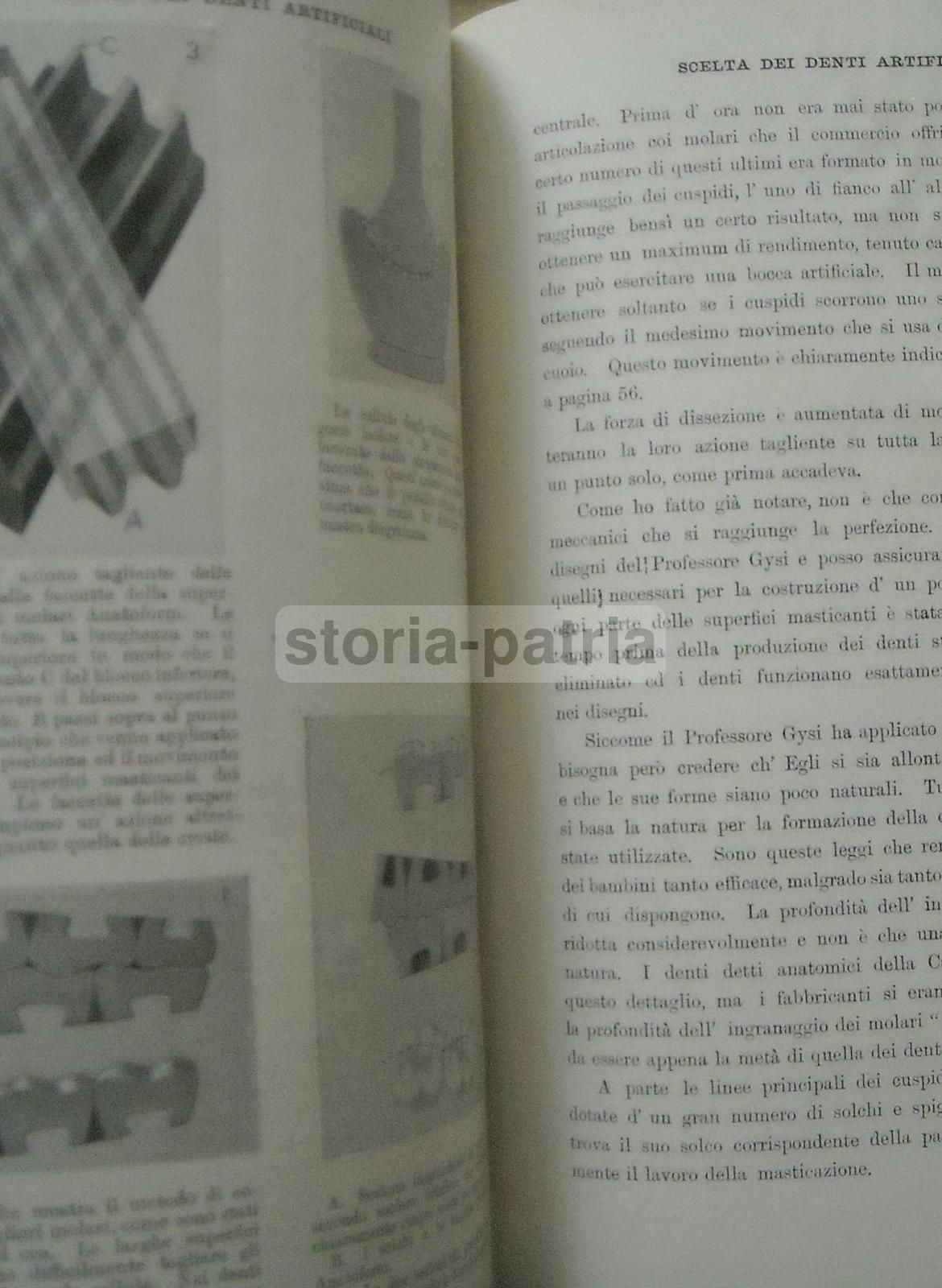 Scelta Dei Denti Artificiali: Sistema Anatoform Di J. Leon Williams (1920)