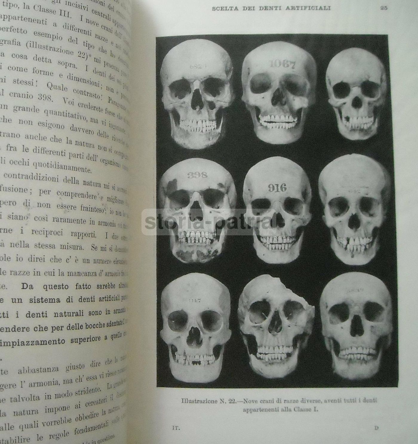 Scelta Dei Denti Artificiali: Sistema Anatoform Di J. Leon Williams (1920)
