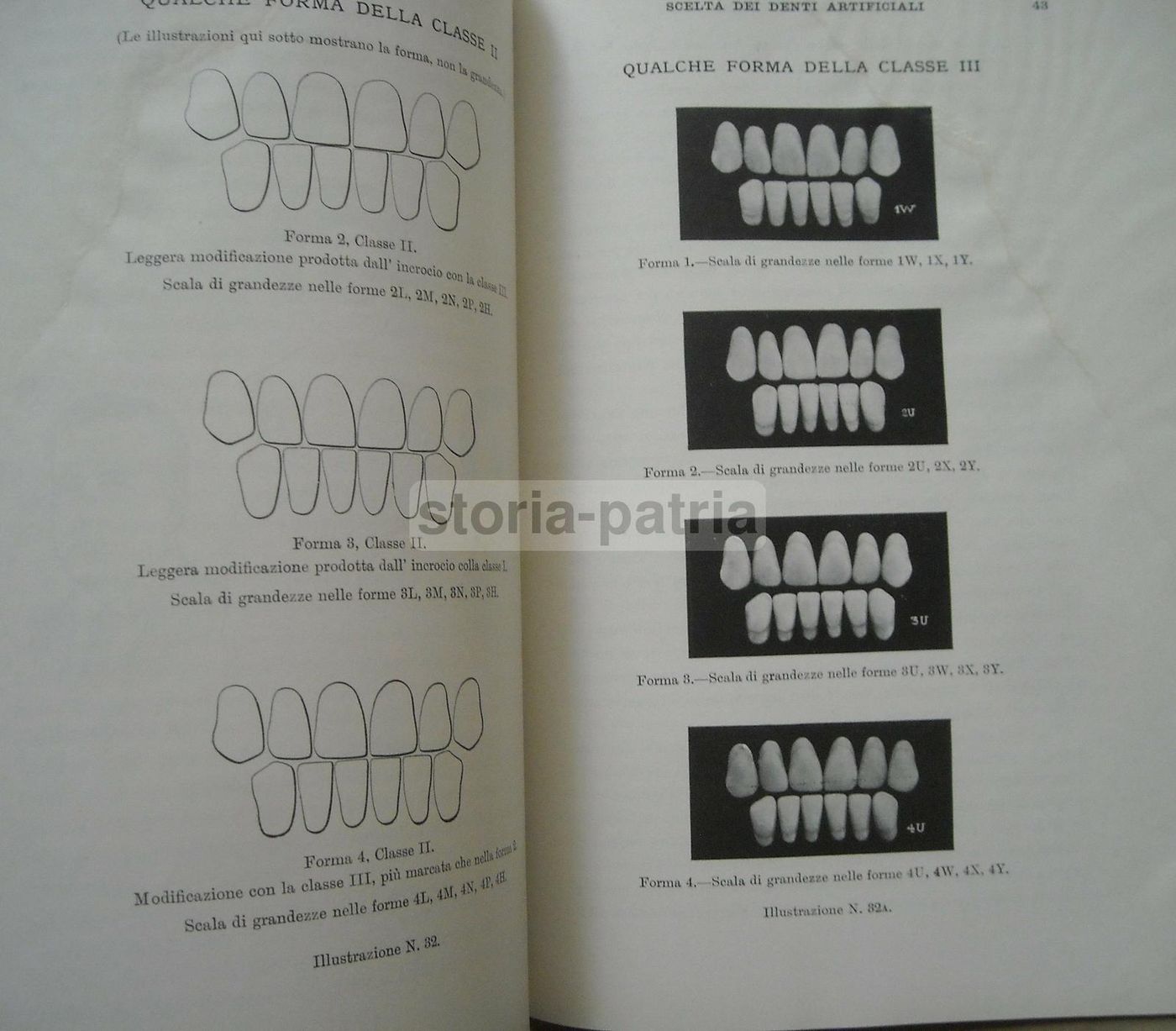 Scelta Dei Denti Artificiali: Sistema Anatoform Di J. Leon Williams (1920)