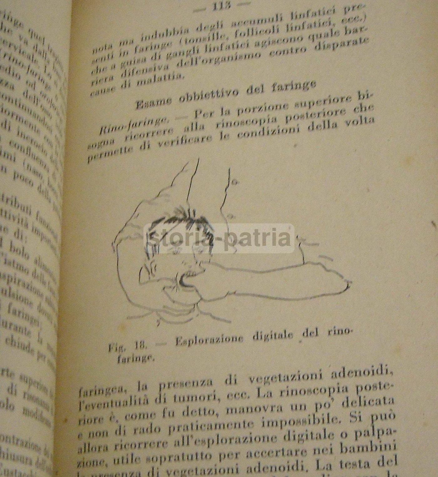 Nozioni Pratiche Di Otorinolaringoiatria   Sanvenero Rosselli   1930