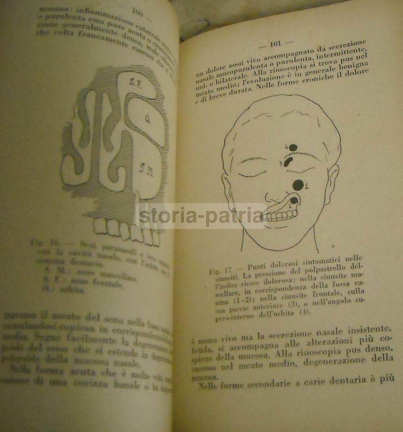 Nozioni Pratiche Di Otorinolaringoiatria   Sanvenero Rosselli   1930
