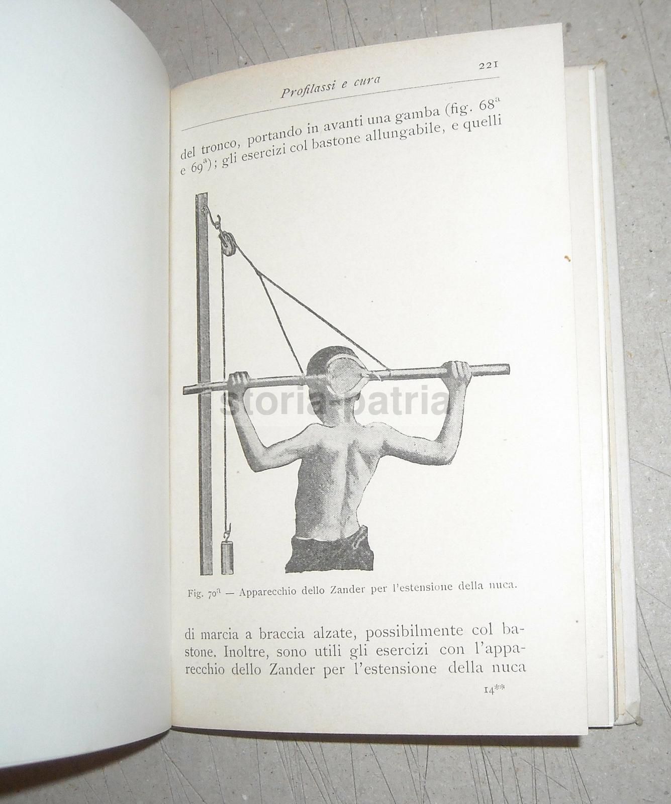 La Rachidite Di Paolo Mancini (Hoepli 1904). Ortopedia E Deformità