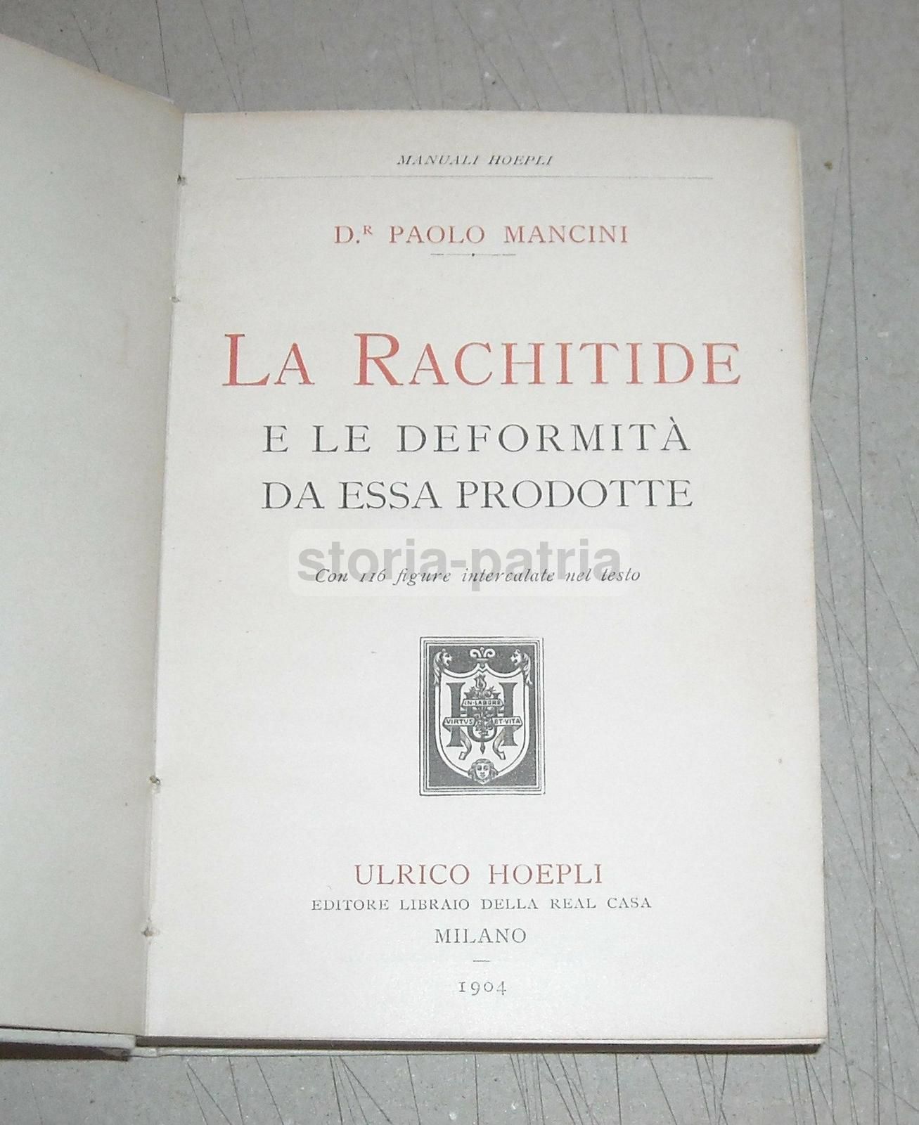 La Rachidite Di Paolo Mancini (Hoepli 1904). Ortopedia E Deformità