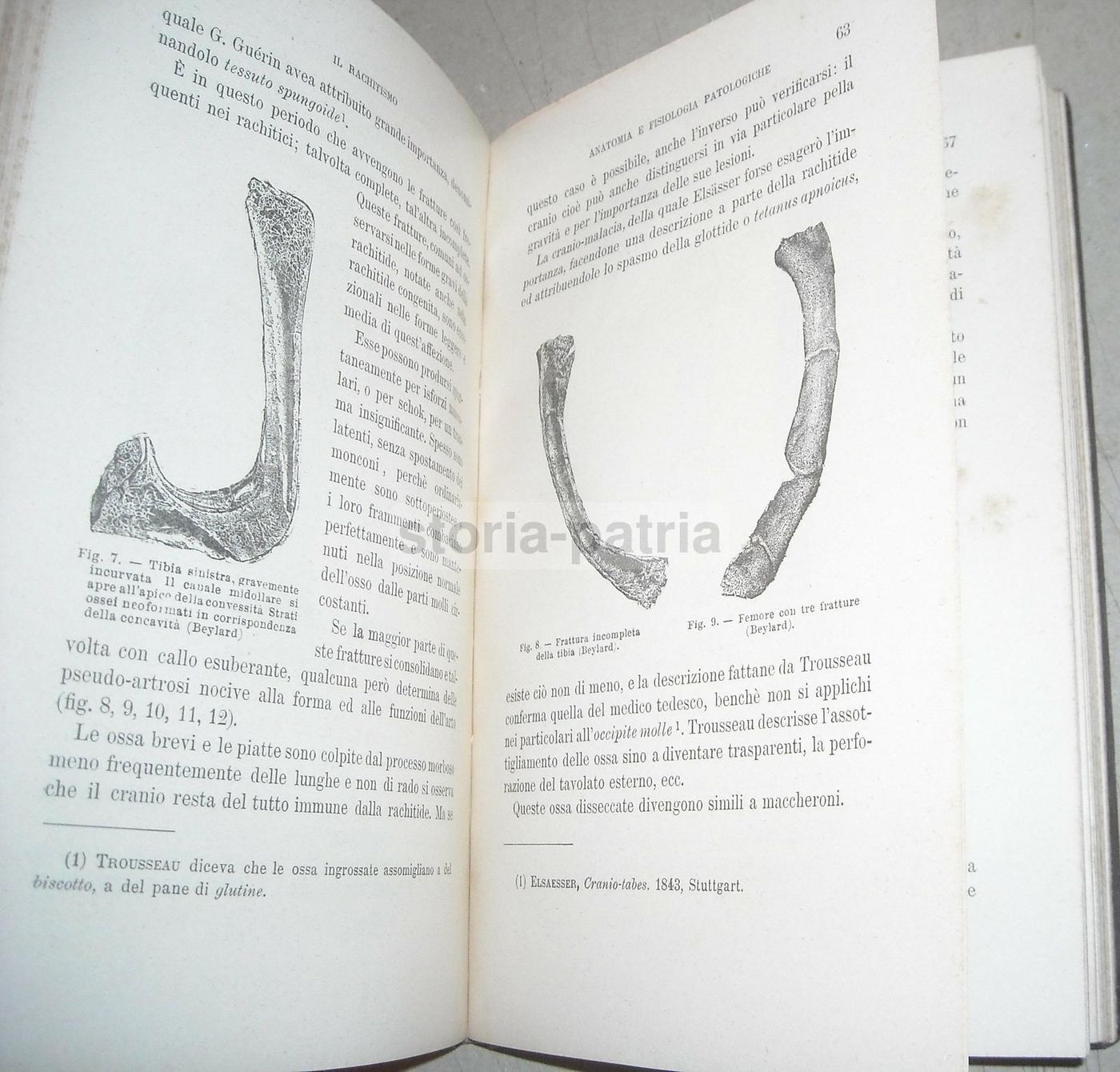 Il Rachitismo Di J. Comby 1894: Medicina E Ortopedia, UTET Torino