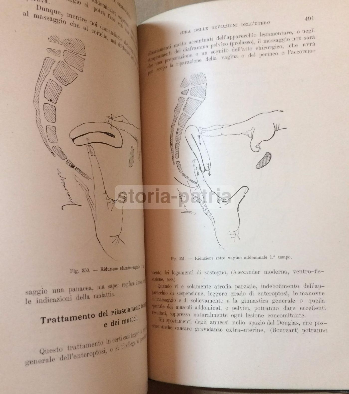 Fisioterapia, Chinesiterapia, Massaggio. Vallardi, 1912. Illustrato