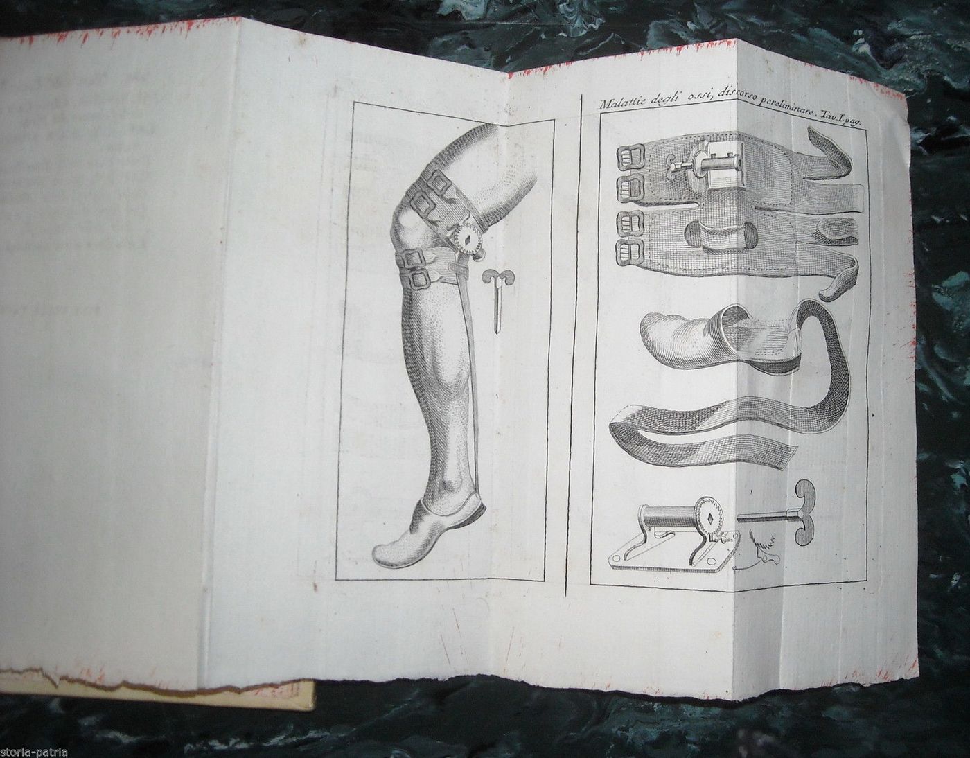Trattato Delle Malattie Delle Ossa Di Petit, Parma 1799