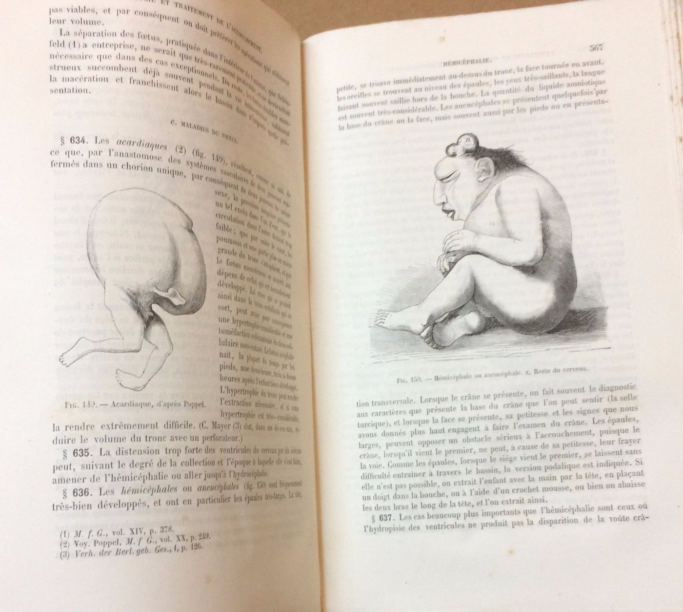 Manuale Di Ostetricia Schroder 1875: Gravidanza, Patologie, Parto