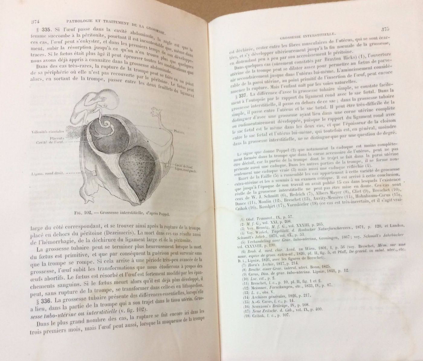 Manuale Di Ostetricia Schroder 1875: Gravidanza, Patologie, Parto