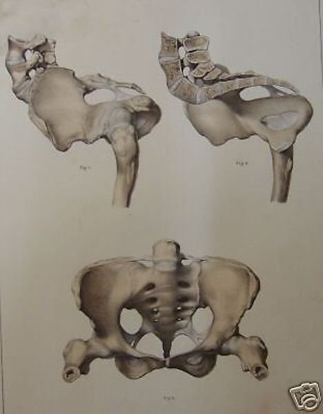 Litografia Antica Apparato Osseo Bacino Femminile Ostetricia 1800