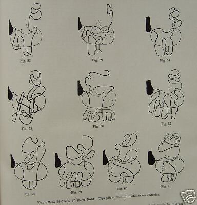 Semeiotica E Diagnostica Rontgen. Ruggero Balli, 1948 1956