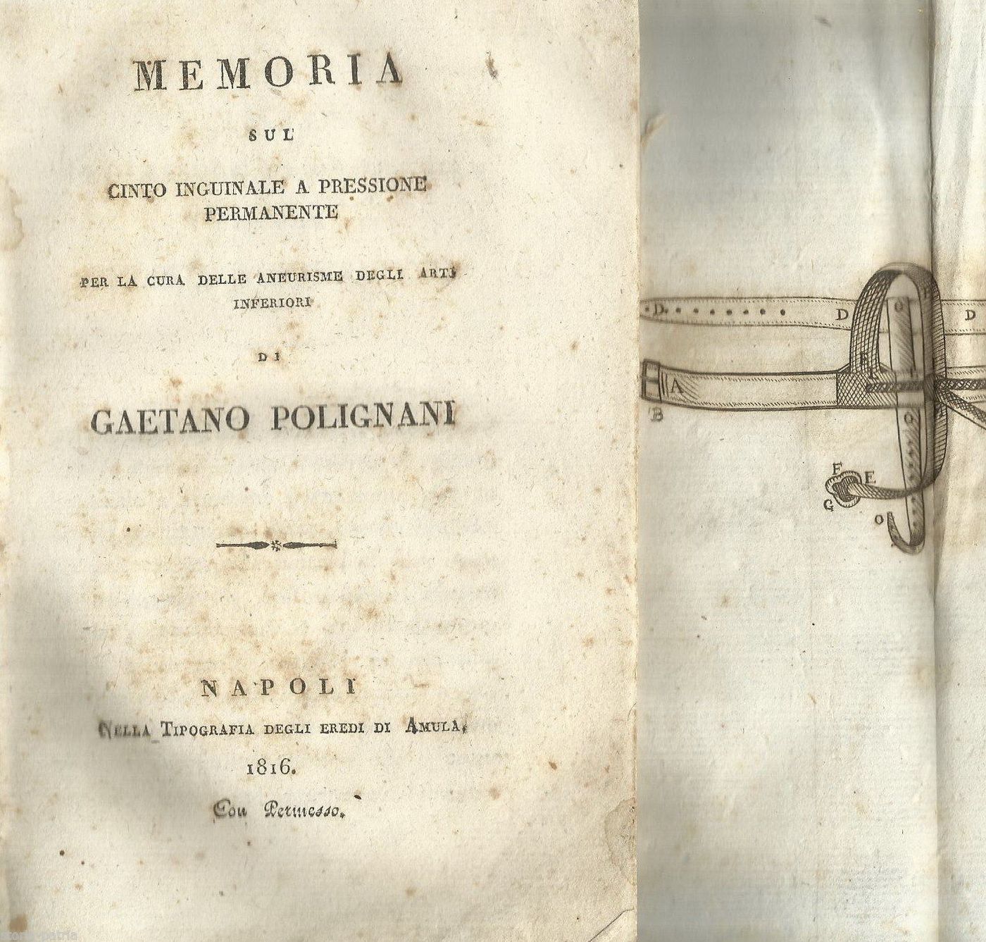 Polignani: Memoria Sul Cinto Inguinale A Pressione Permanente, Napoli, 1816