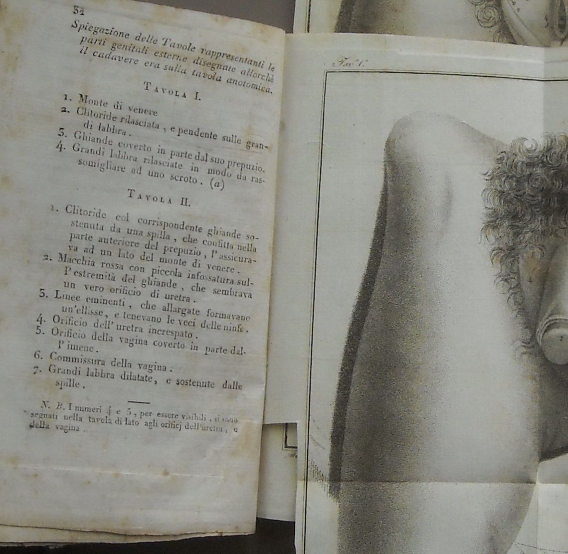 Trinchera, Memoria Sopra Un Caso Di Apparente Ermafrodito, Napoli, 1817