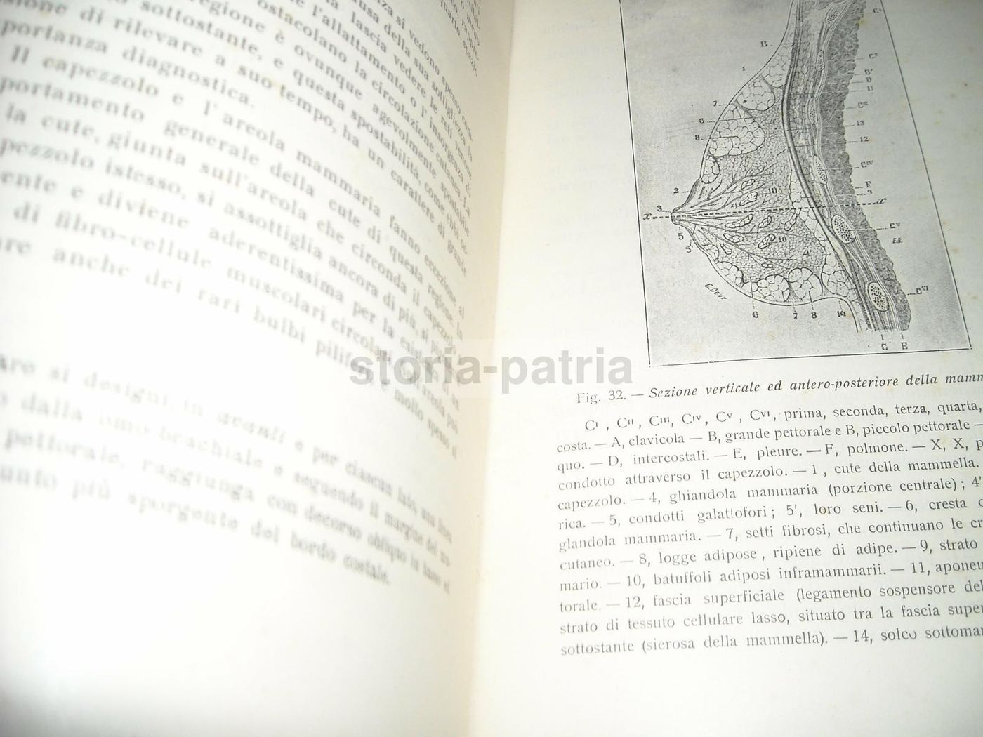 Sabino Lembo: La Radiumchirurgia Del Cancro Della Mammella (1927)